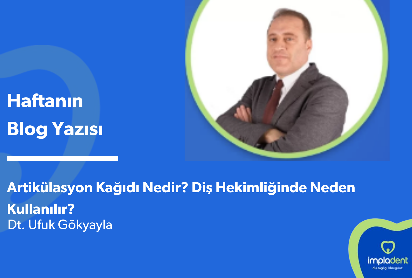 Artikülasyon Kağıdı Nedir? Diş Hekimliğinde Neden Kullanılır?