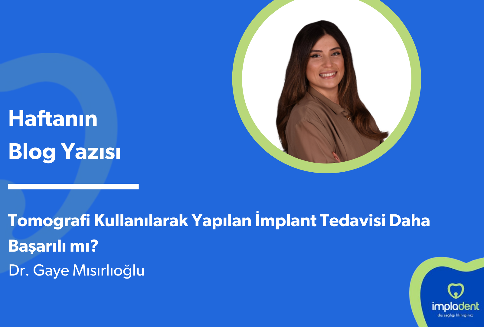 Tomografi Kullanılarak Yapılan İmplant Tedavisi Daha Başarılı mı?