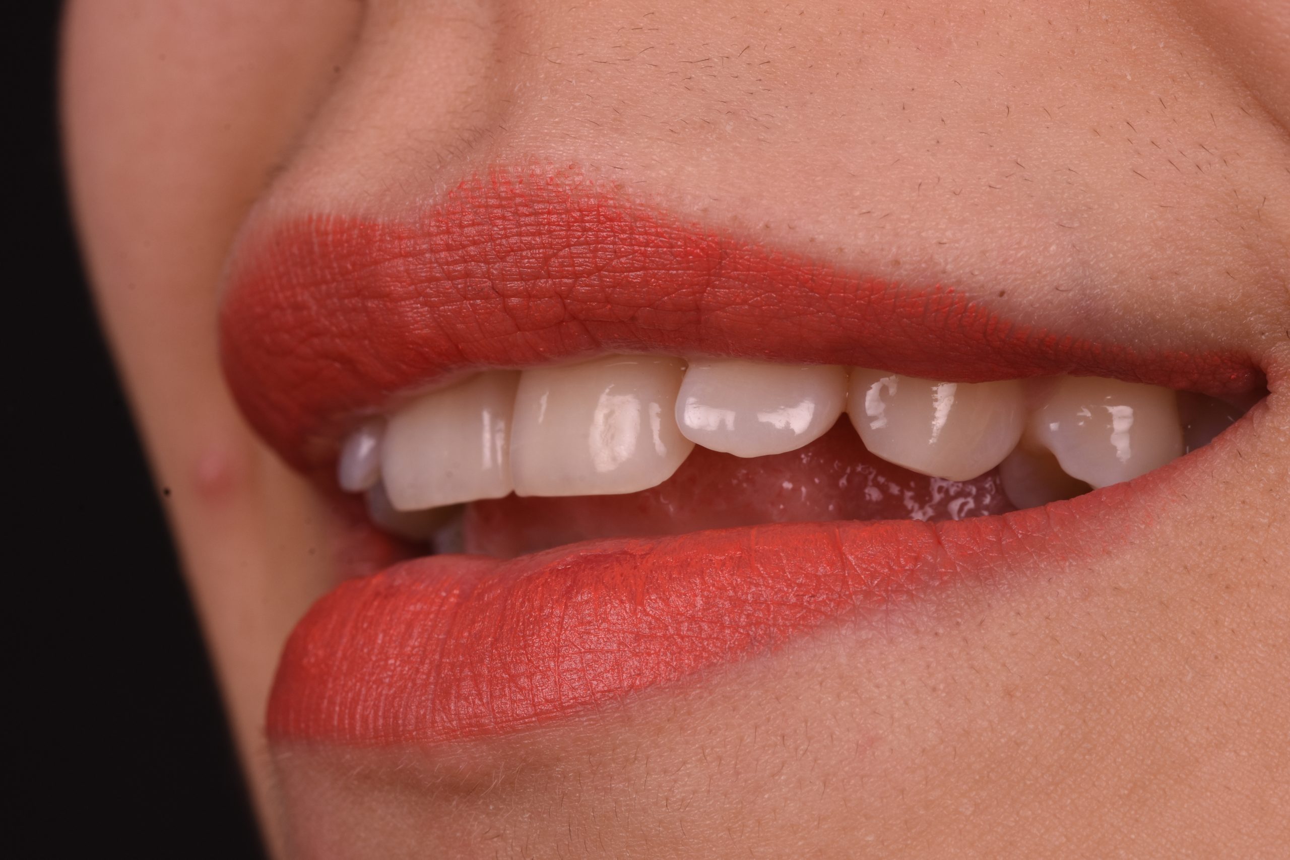 Periodontoloji (Diş Eti Hastalıkları)