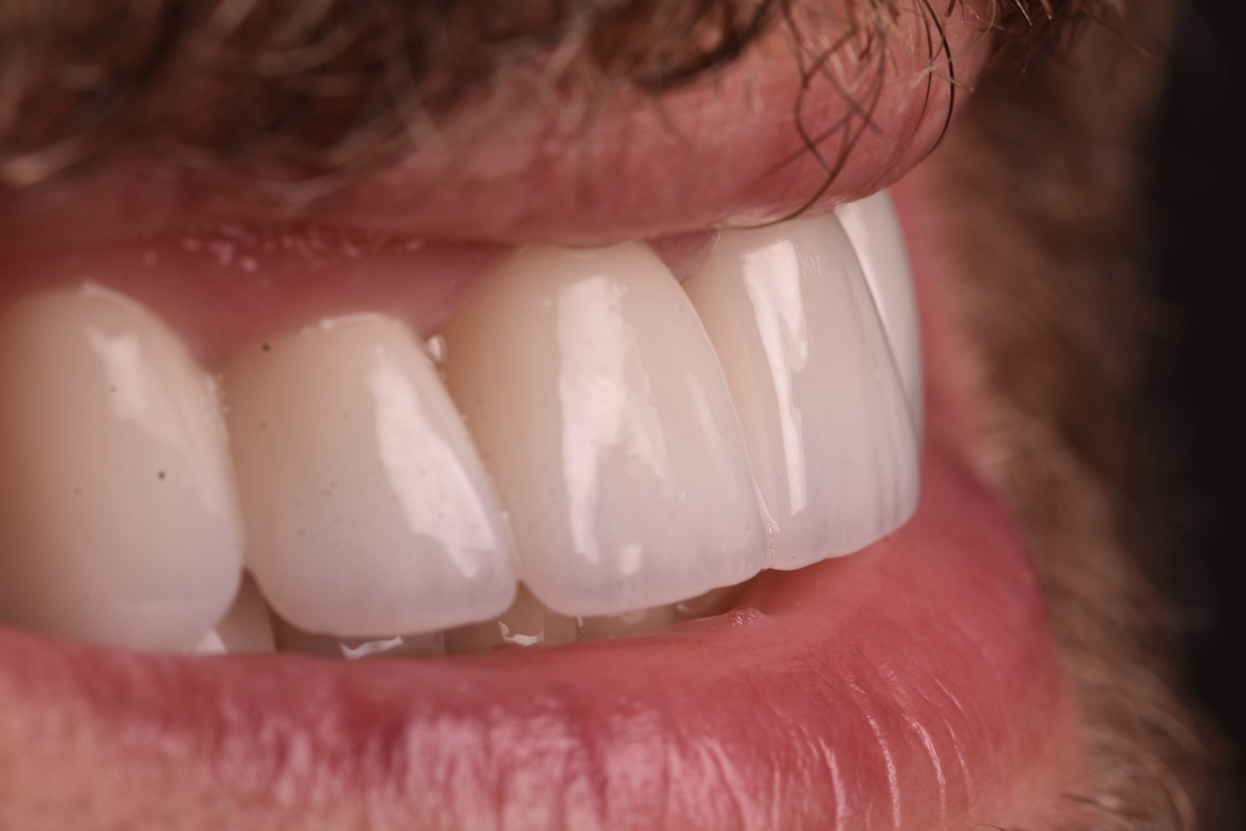 Oral Diagnoz (İlk Muayene)